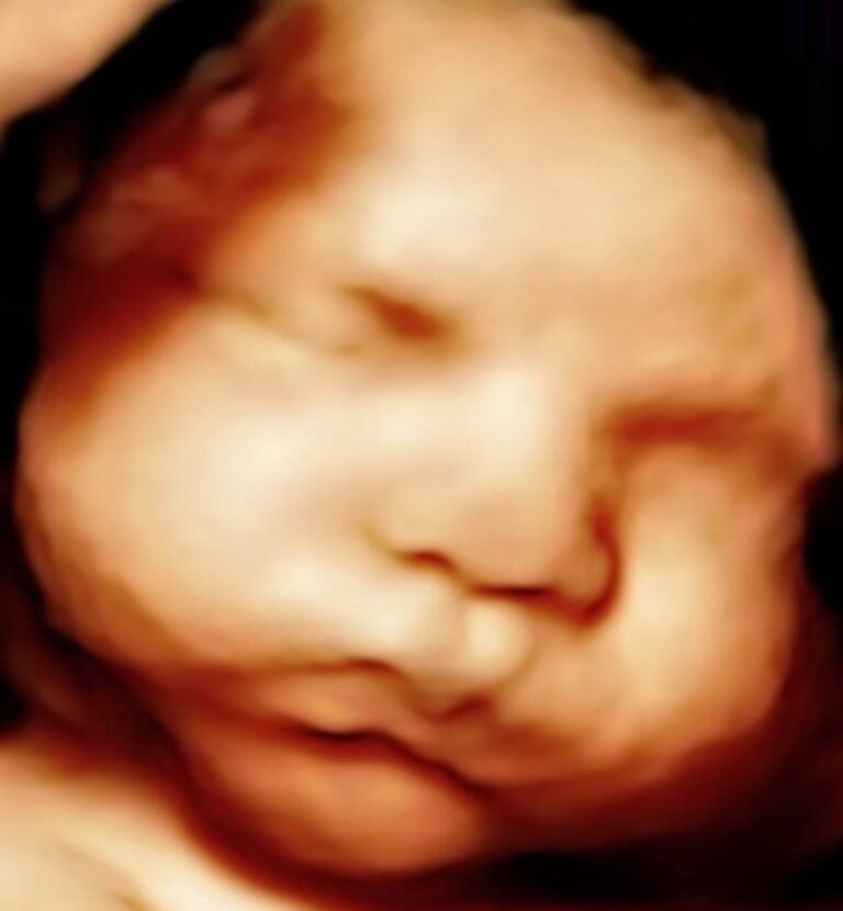 baby ultrasound image